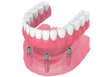 ED teeth3